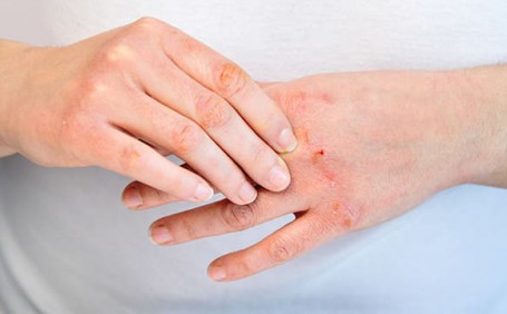 乳膠手套能否有效防止長(zhǎng)水泡？